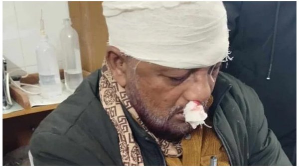 কাপ্তাইয়ে দুই আ’লীগ নেতার উপর হামলা